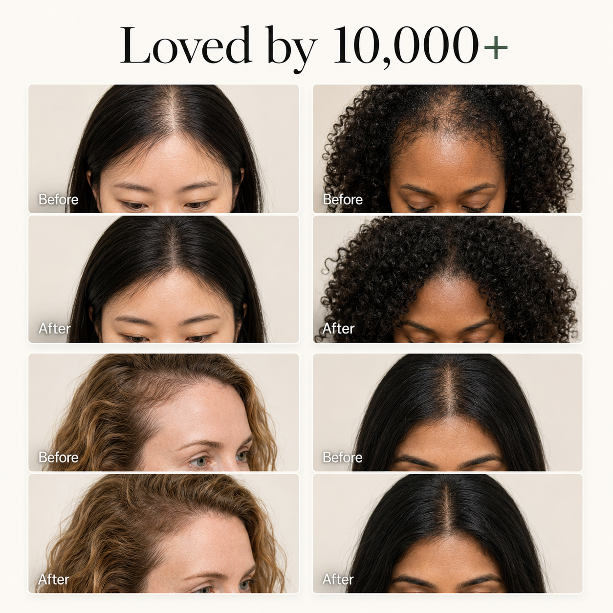 Korean Scalp Revival Bar
