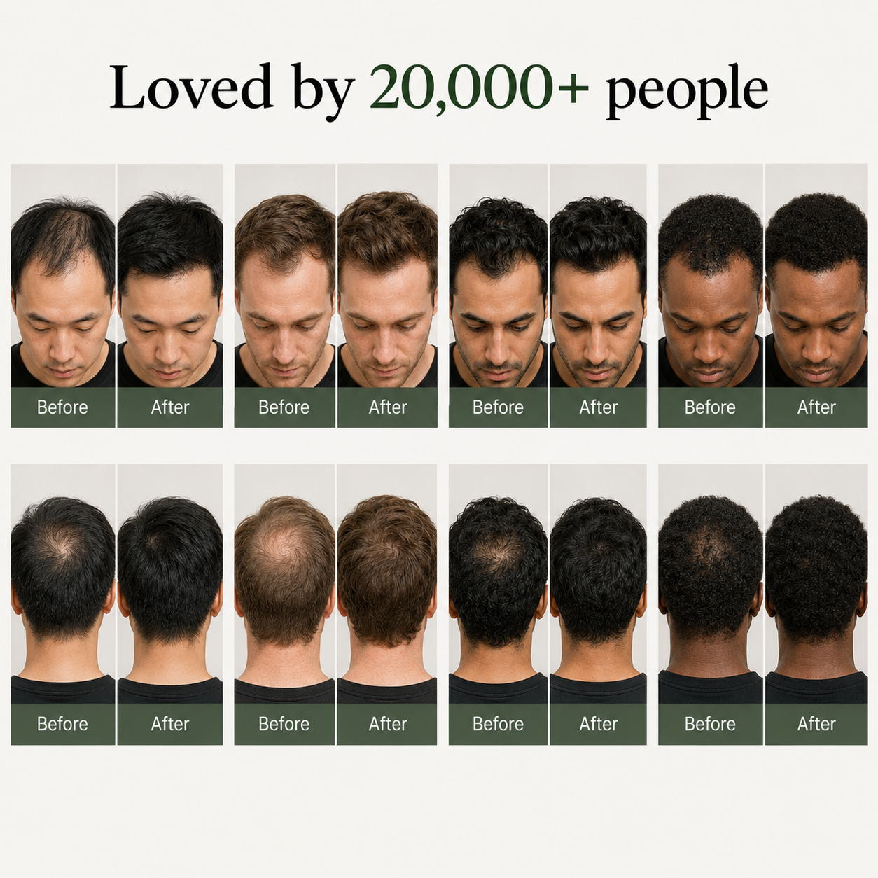 Korean Scalp Revival Bar