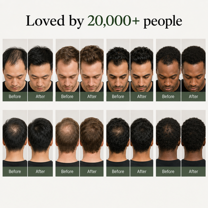Korean Scalp Revival Bar